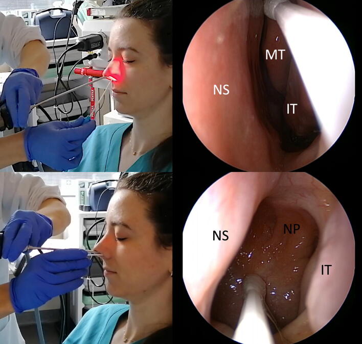 Fig. 1