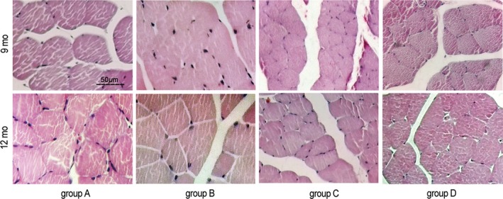 Figure 13