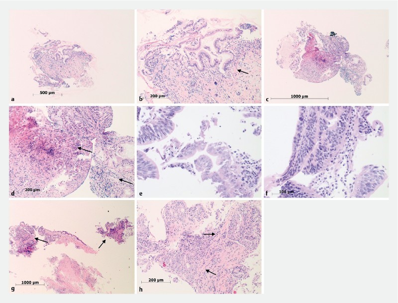 Fig. 2