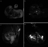 Fig. 10