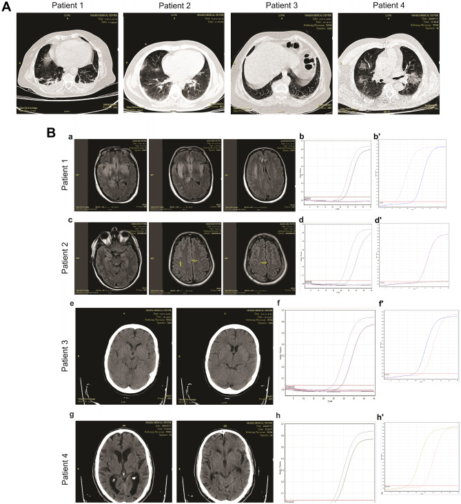 Fig. 1