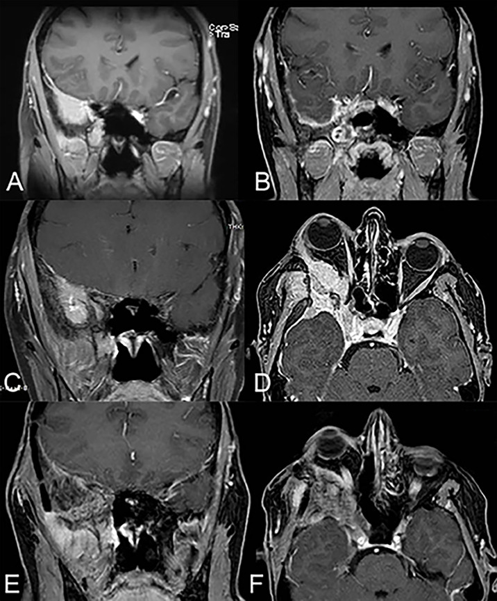 Figure 2