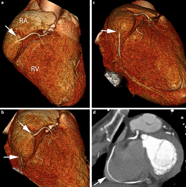 Fig. 1a–c