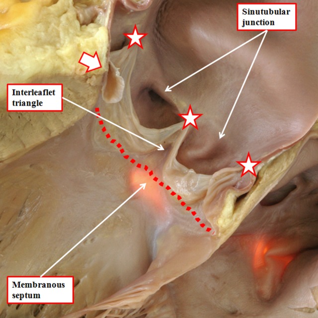 Figure 15.