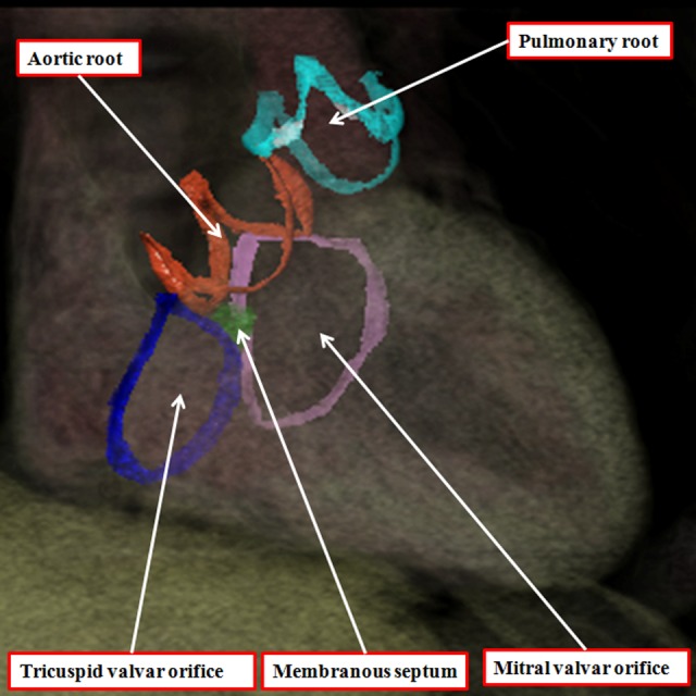 Figure 14.