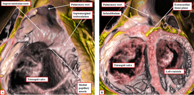 Figure 17.