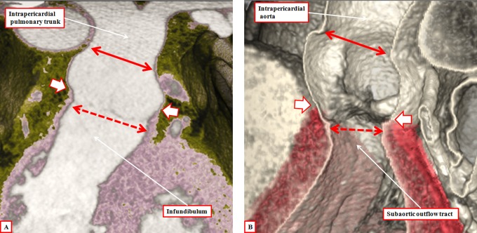 Figure 13.