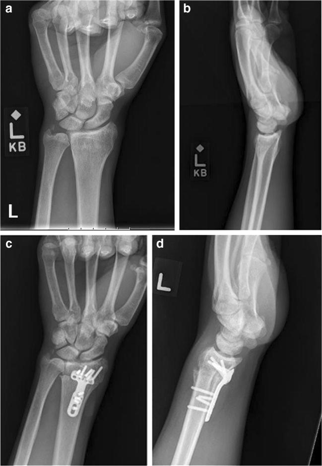 Fig. 2
