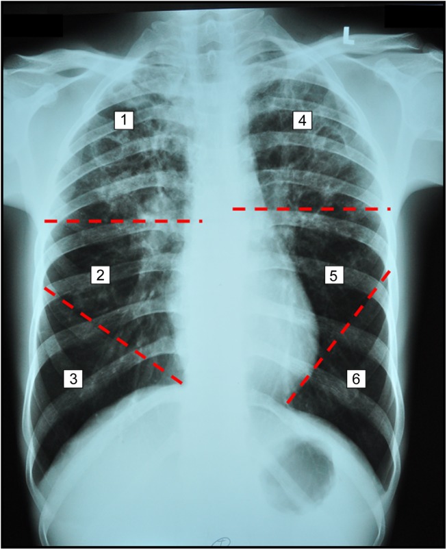 Fig 2