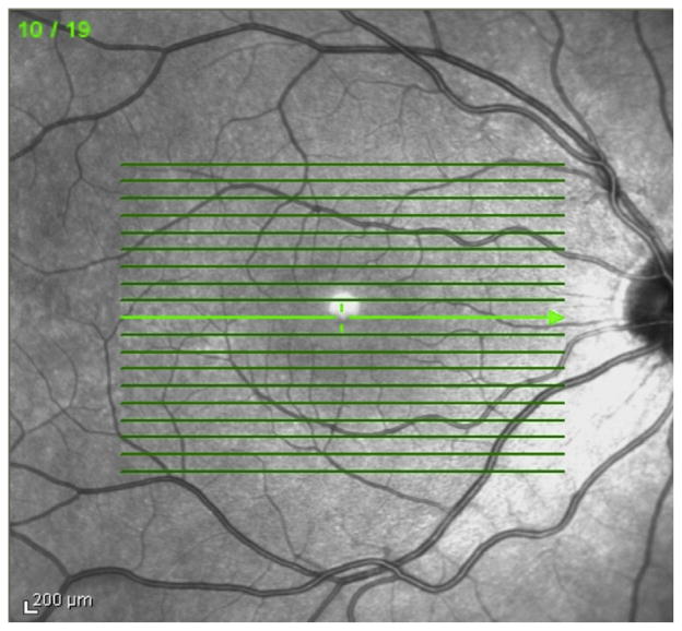 FIG 2