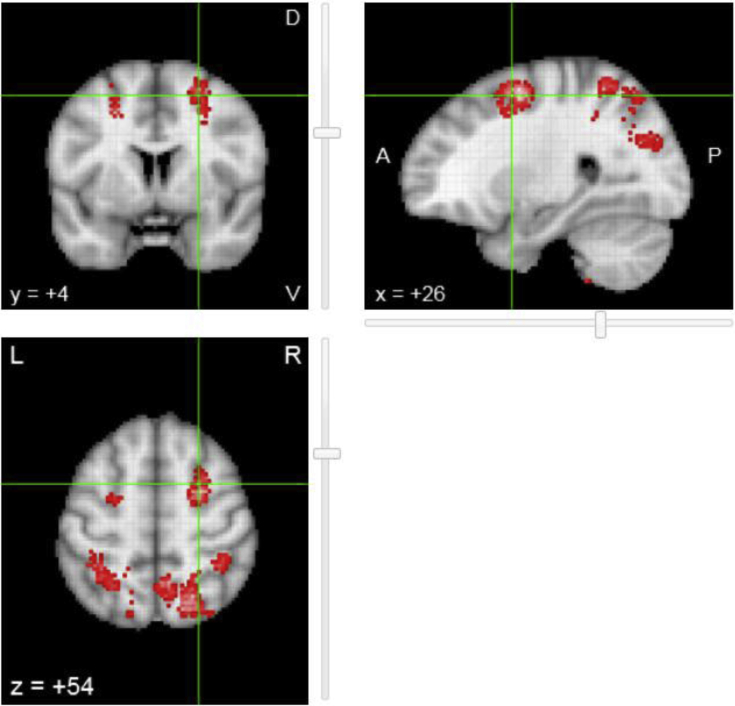 Fig. 4