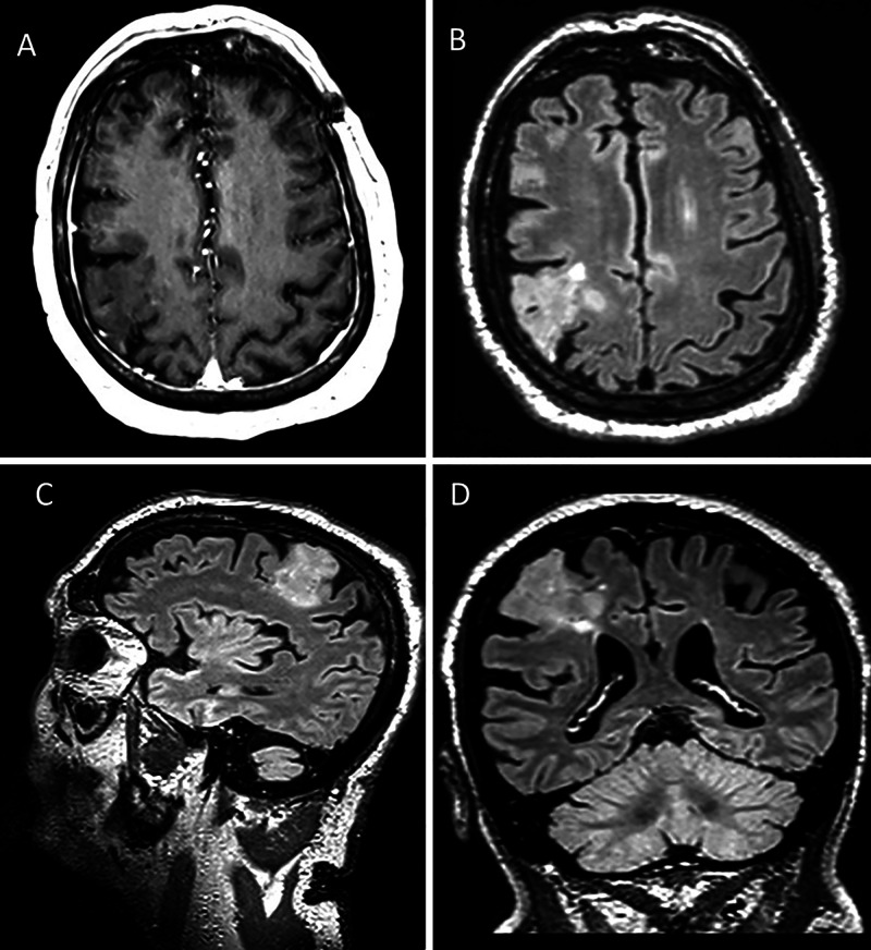 FIG. 1.