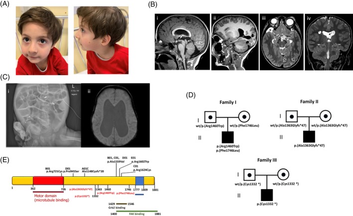 FIGURE 1