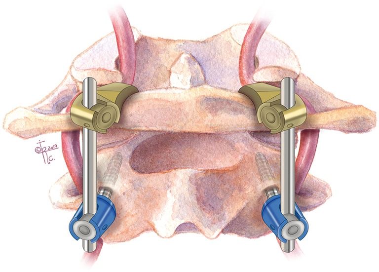 Figure 10