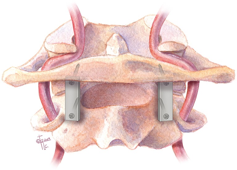 Figure 5