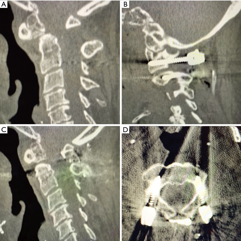 Figure 11