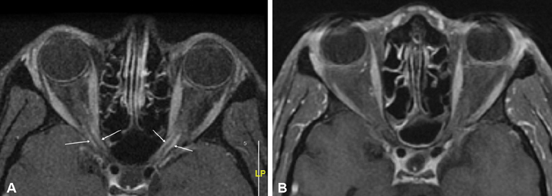 Fig. 12