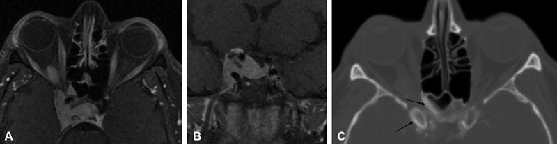 Fig. 20