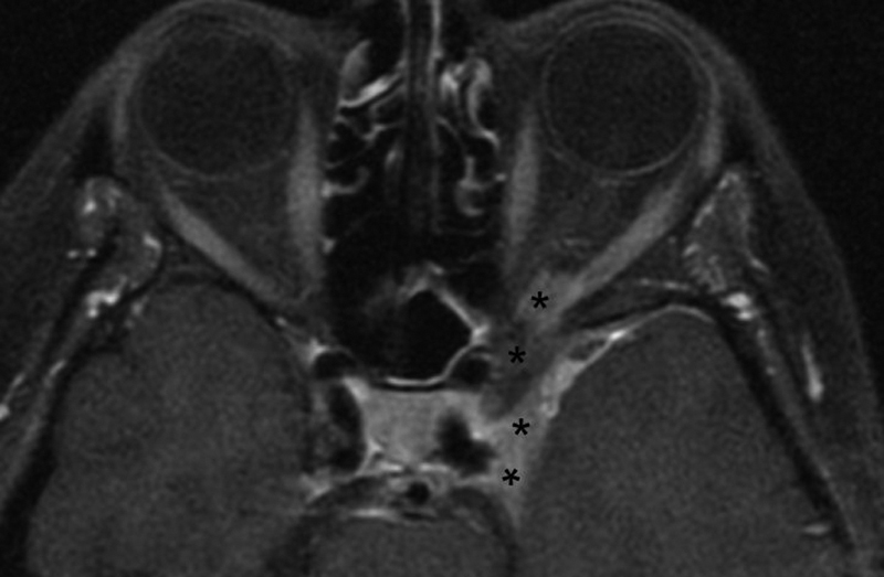 Fig. 19