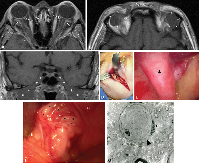 Fig. 15