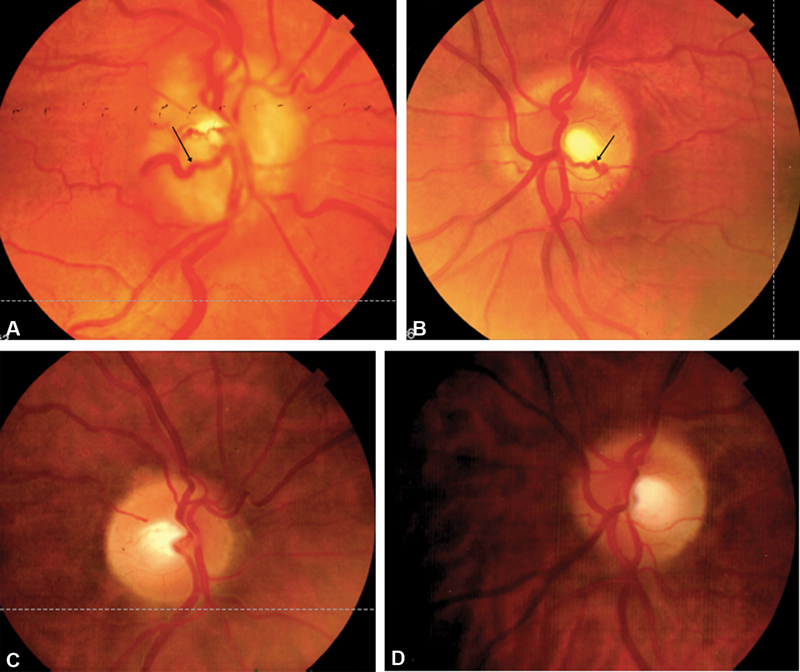 Fig. 6