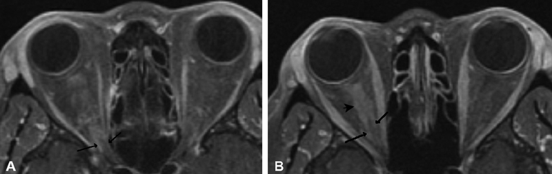 Fig. 11