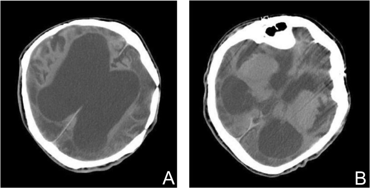 Fig. 1.