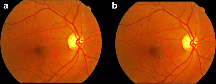 Fig. 4