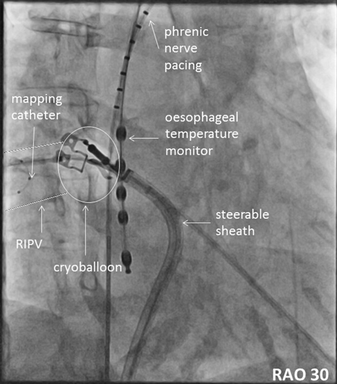 Figure 2: