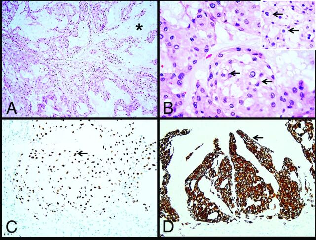 FIG 3.