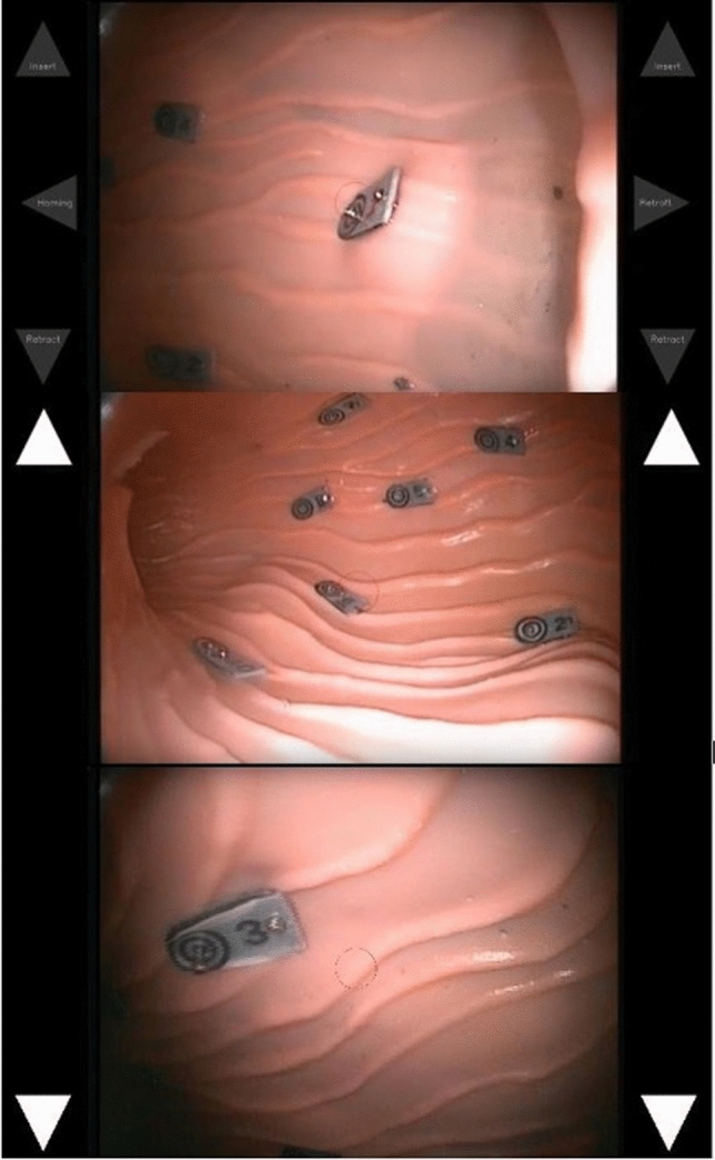 Fig. 3