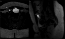 Fig. 12
