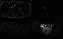 Fig. 11
