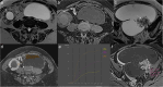 Fig. 16