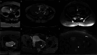 Fig. 13