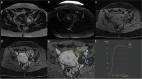 Fig. 14