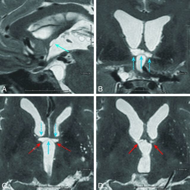 Fig 3.