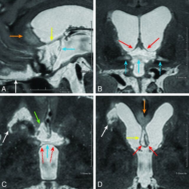 Fig 4.