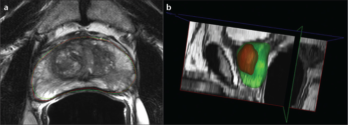 Figure 3. a, b.