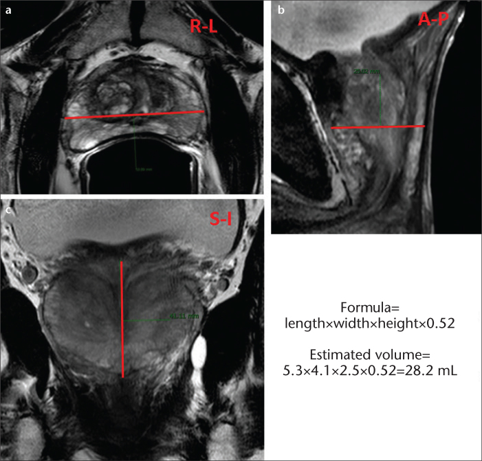 Figure 2. a–c.