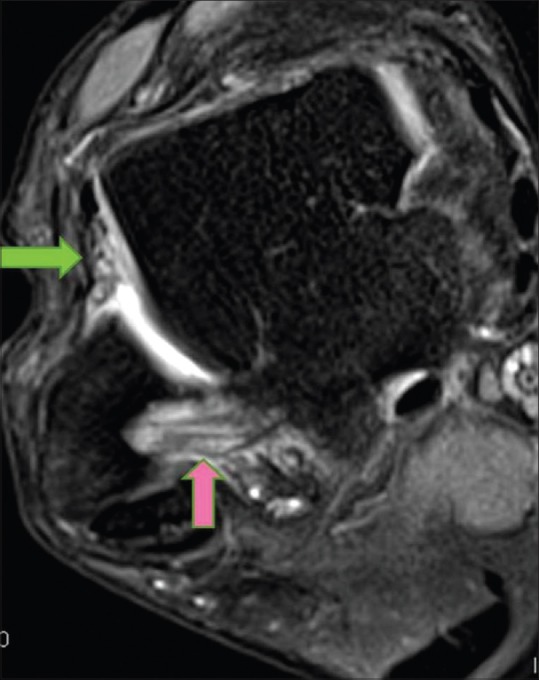 Figure 14