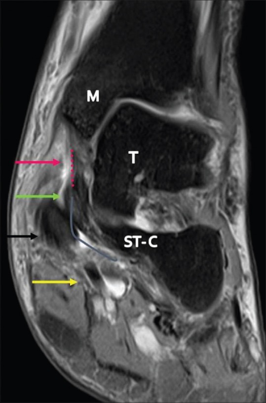 Figure 18