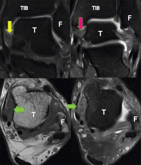 Figure 17