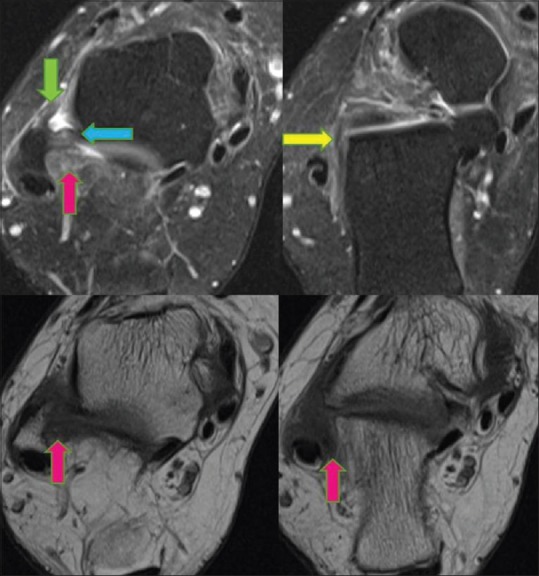 Figure 16