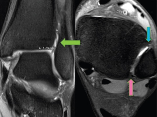 Figure 15