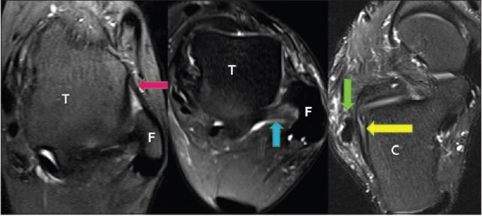 Figure 3 (A)