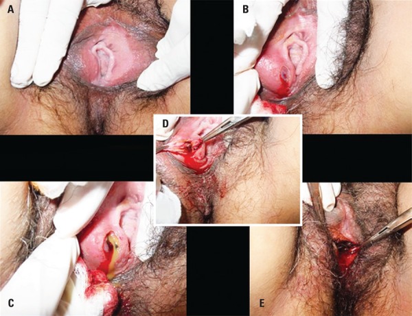 Figura 1