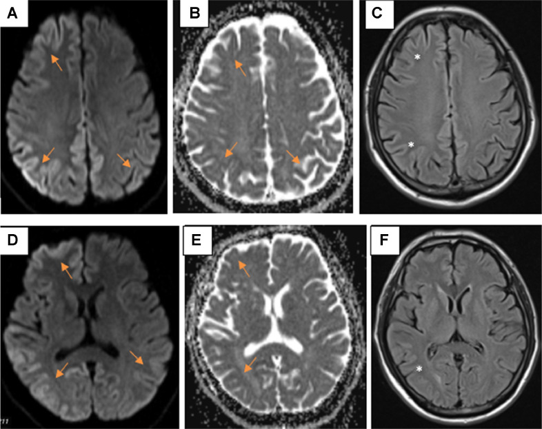 Fig 2: