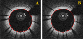 Fig. 9