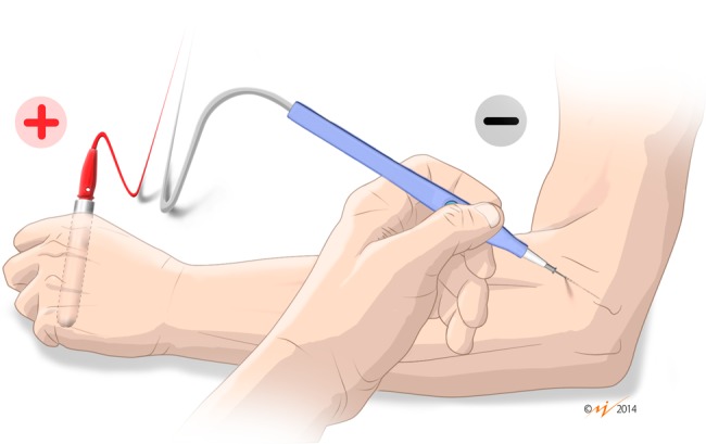 Figure 2